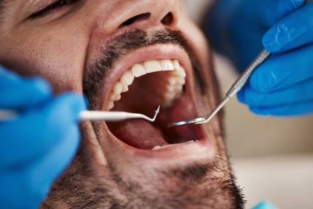 Best Emergency Dental Care for Abscessed Tooth in Ntgomery City, MO