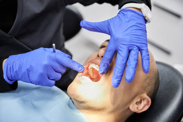 Best Emergency Dental Extractions in Ntgomery City, MO