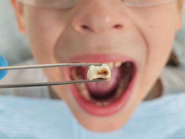 Best 24-Hour Emergency Dentist in Ntgomery City, MO