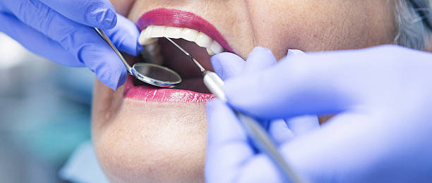 Best Broken or Cracked Tooth Emergency Dentist in Ntgomery City, MO